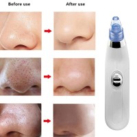 Clean Blackhead Machine Electric Blackhead Remover Skin Care Device Face Pore Acne Pimple Removal Beauty Machine